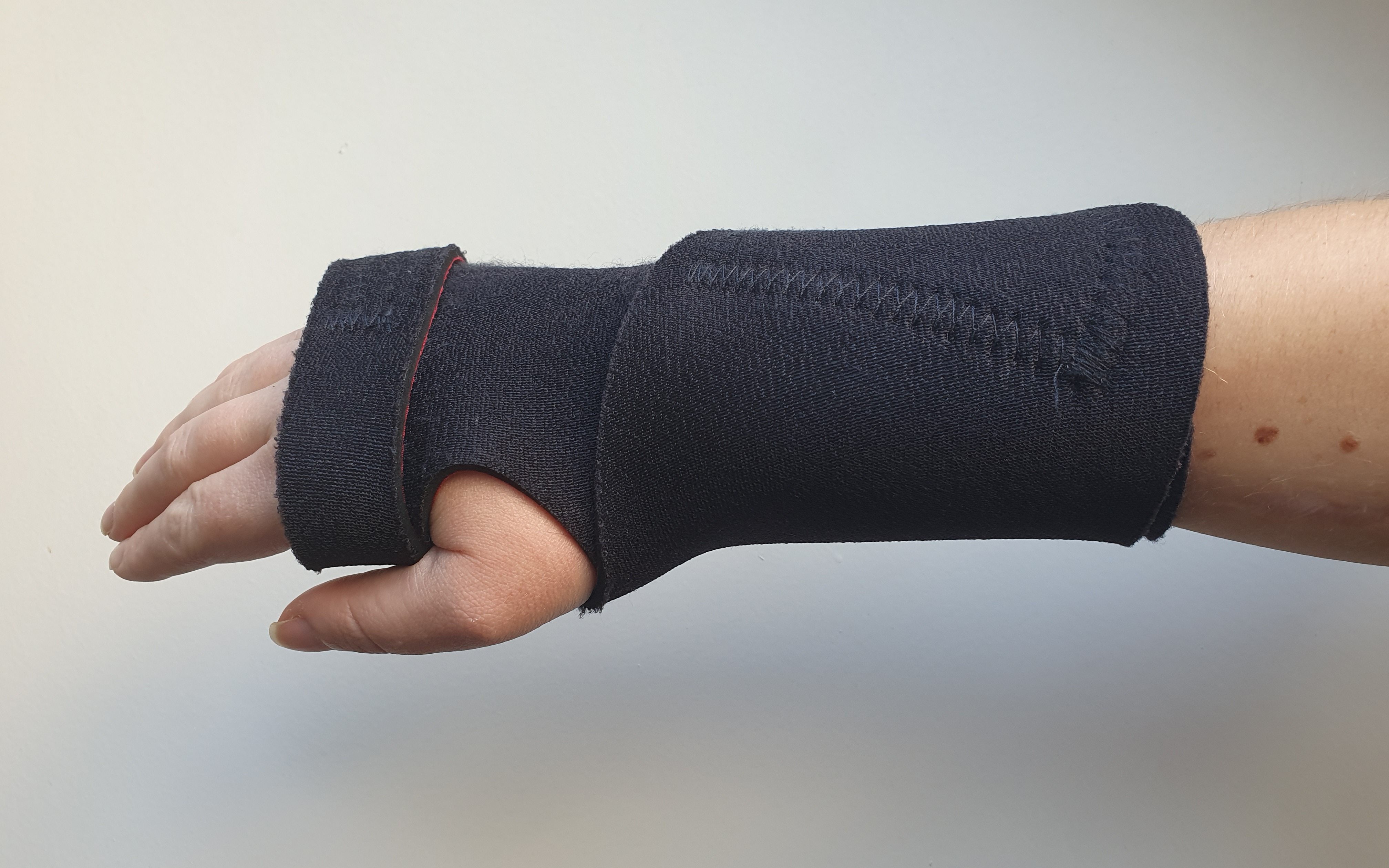 Neoprene wrist splint secured across the back of the hand and wrist by velcro straps